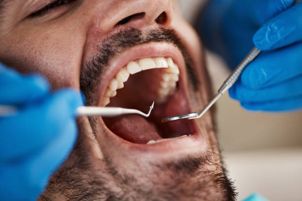 Urgent Tooth Repair in CT