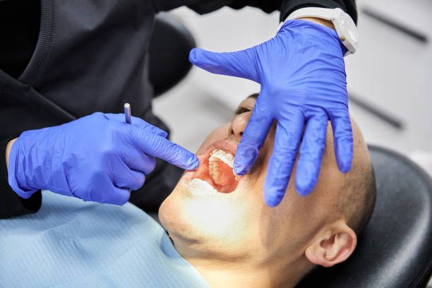 Best Chipped Tooth Repair Near Me  in Blue Hills, CT